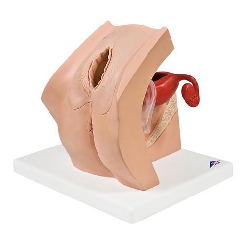 3B Gynecological Training Model For Patient Education