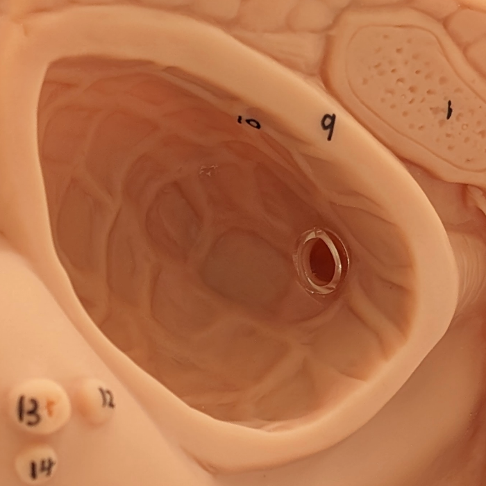 A flesh-toned anatomical model shows a cavity with a small transparent tube inserted, numbered anatomical features are visible. Numbers 9, 10, 11, 12, 13, and 14 are written on the model.