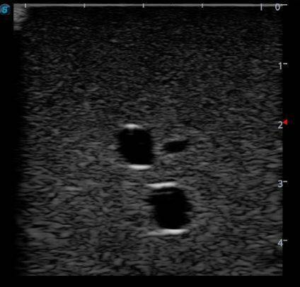 Anatomy Lab Femoral Arteriovenous Puncture and Abdominocentesis Ultrasound Training Model