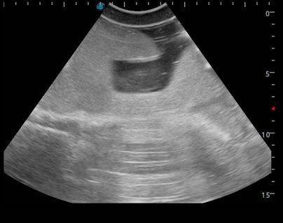 Anatomy Lab Femoral Arteriovenous Puncture and Abdominocentesis Ultrasound Training Model