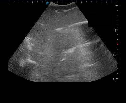 Anatomy Lab Femoral Arteriovenous Puncture and Abdominocentesis Ultrasound Training Model