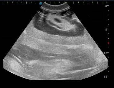 Anatomy Lab Femoral Arteriovenous Puncture and Abdominocentesis Ultrasound Training Model