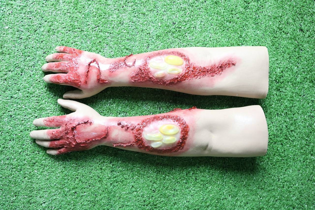 Anatomy Lab Moulage - Wearable Burn Arms