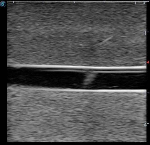 Anatomy Lab Vascular Access Ultrasound Training Model